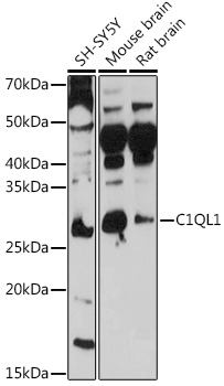 Western blot analysis of extracts of various cell lines using C1QL1 Polyclonal Antibody at 1:1000 dilution.