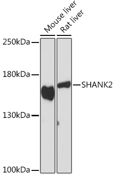 Western blot analysis of extracts of various cell lines using SHANK2 Polyclonal Antibody at1:1000 dilution.