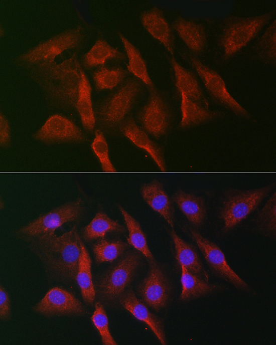 Immunofluorescence analysis of NIH-3T3 cells using MKNK1 Polyclonal Antibody at dilution of 1:50 (40x lens). Blue: DAPI for nuclear staining.