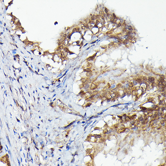 Immunohistochemistry of paraffin-embedded rat fallopian tube using MKNK1 Polyclonal Antibody at dilution of 1:50 (40x lens).Perform high pressure antigen retrieval with 10 mM citrate buffer pH 6.0 before commencing with IHC staining protocol.