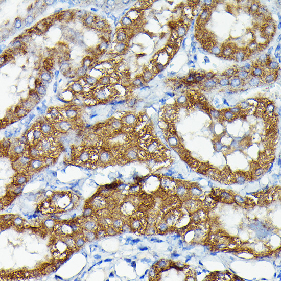 Immunohistochemistry of paraffin-embedded mouse kidney using MKNK1 Polyclonal Antibody at dilution of 1:50 (40x lens).Perform high pressure antigen retrieval with 10 mM citrate buffer pH 6.0 before commencing with IHC staining protocol.