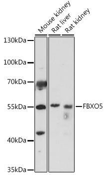 Western blot analysis of extracts of various cell lines using FBXO5 Polyclonal Antibody at 1:1000 dilution.