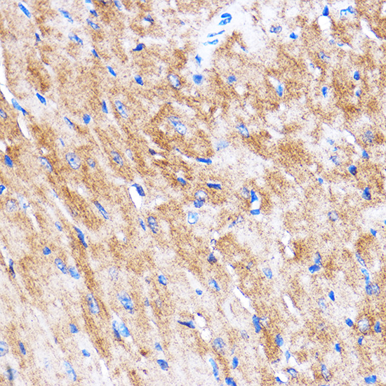 Immunohistochemistry of paraffin-embedded Mouse heart using HSPB7 Polyclonal Antibody at dilution of 1:100 (40x lens).Perform microwave antigen retrieval with 10 mM PBS buffer pH 7.2 before commencing with IHC staining protocol.