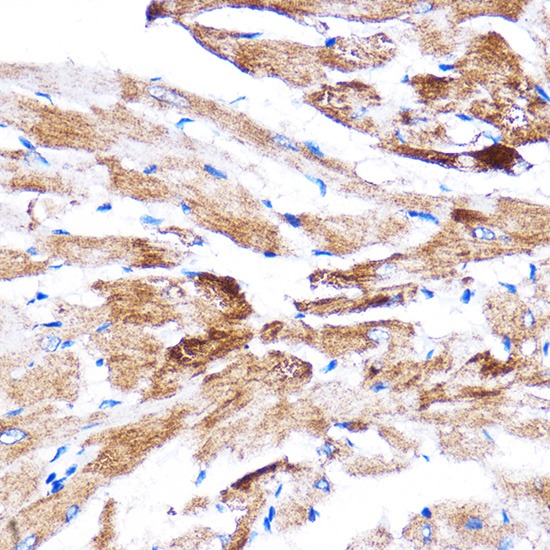 Immunohistochemistry of paraffin-embedded Rat heart using HSPB7 Polyclonal Antibody at dilution of 1:100 (40x lens).Perform microwave antigen retrieval with 10 mM PBS buffer pH 7.2 before commencing with IHC staining protocol.