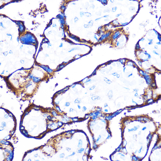 Immunohistochemistry of paraffin-embedded Human placenta using HSPB7 Polyclonal Antibody at dilution of 1:100 (40x lens).Perform microwave antigen retrieval with 10 mM PBS buffer pH 7.2 before commencing with IHC staining protocol.