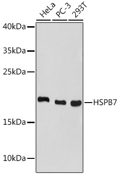 Western blot analysis of extracts of various cell lines using HSPB7 Polyclonal Antibody at 1:1000 dilution.