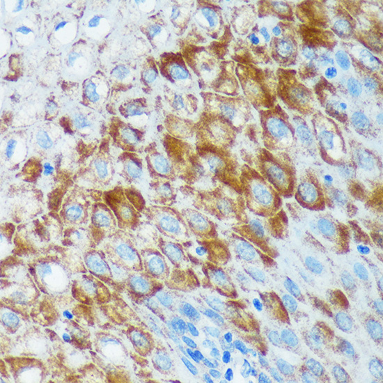 Immunohistochemistry of paraffin-embedded Human esophageal using IER5 Polyclonal Antibody at dilution of 1:100 (40x lens).Perform microwave antigen retrieval with 10 mM PBS buffer pH 7.2 before commencing with IHC staining protocol.