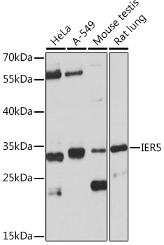 Western blot analysis of extracts of various cell lines using IER5 Polyclonal Antibody at1:1000 dilution.