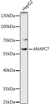 Western blot analysis of extracts of HepG2 cells using ANAPC7 Polyclonal Antibody at 1:1000 dilution.