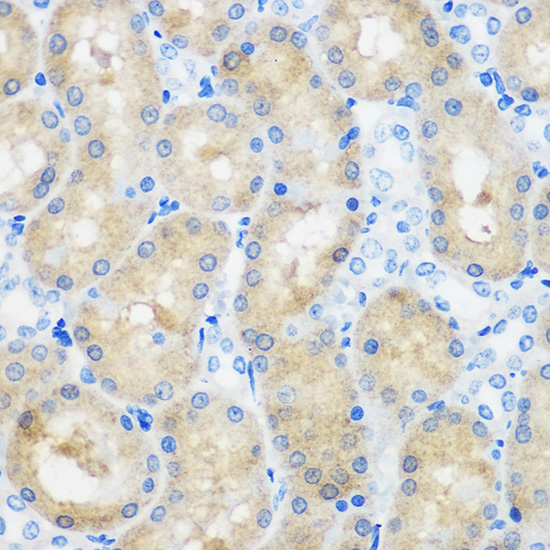 Immunohistochemistry of paraffin-embedded Rat kidney using C9orf114 Polyclonal Antibody at dilution of 1:100 (40x lens).Perform microwave antigen retrieval with 10 mM PBS buffer pH 7.2 before commencing with IHC staining protocol.