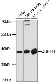 Western blot analysis of extracts of various cell lines using ZNF444 Polyclonal Antibody at1:1000 dilution.