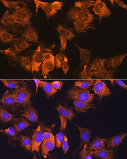 Immunofluorescence analysis of C6 cells using CDV3 Polyclonal Antibody at dilution of 1:100. Blue: DAPI for nuclear staining.