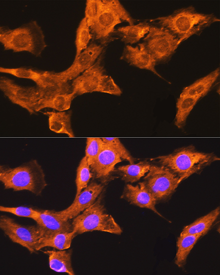 Immunofluorescence analysis of L929 cells using CDV3 Polyclonal Antibody at dilution of 1:100. Blue: DAPI for nuclear staining.