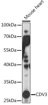 Western blot analysis of extracts of Mouse heart using CDV3 Polyclonal Antibody at1:1000 dilution.