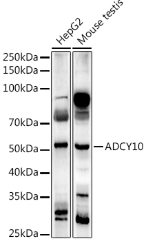 Western blot analysis of extracts of various cell lines using ADCY10 Polyclonal Antibody at 1:1000 dilution.