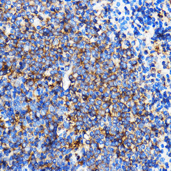 Immunohistochemistry of paraffin-embedded Rat spleen using SERINC1 Polyclonal Antibody at dilution of 1:100 (40x lens).Perform microwave antigen retrieval with 10 mM PBS buffer pH 7.2 before commencing with IHC staining protocol.