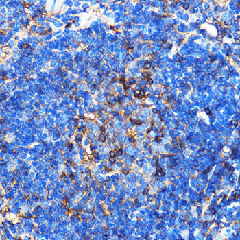 Immunohistochemistry of paraffin-embedded Mouse spleen using SERINC1 Polyclonal Antibody at dilution of 1:100 (40x lens).Perform microwave antigen retrieval with 10 mM PBS buffer pH 7.2 before commencing with IHC staining protocol.