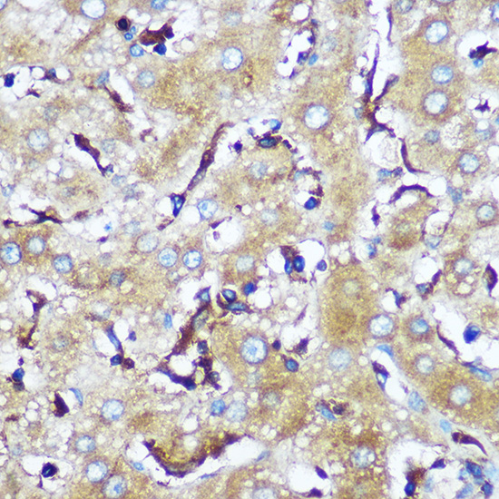 Immunohistochemistry of paraffin-embedded Human liver using SERINC1 Polyclonal Antibody at dilution of 1:100 (40x lens).Perform microwave antigen retrieval with 10 mM PBS buffer pH 7.2 before commencing with IHC staining protocol.