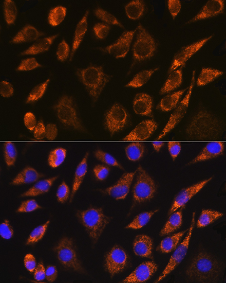 Immunofluorescence analysis of L929 cells using CELF5 Polyclonal Antibody at dilution of 1:100. Blue: DAPI for nuclear staining.