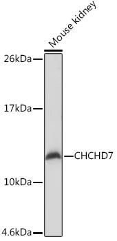 Western blot analysis of extracts of Mouse kidney using CHCHD7 Polyclonal Antibody at1:1000 dilution.