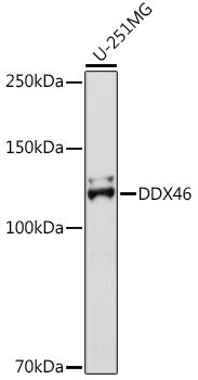 Western blot analysis of extracts of U-251MG cells using DDX46 Polyclonal Antibody at1:500 dilution.