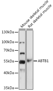 Western blot analysis of extracts of various cell lines using ABTB1 Polyclonal Antibody at 1:1000 dilution.