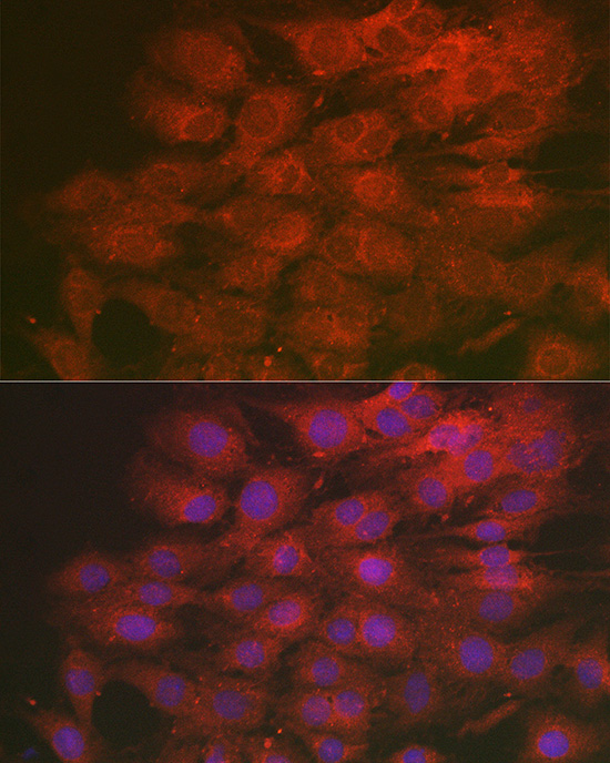 Immunofluorescence analysis of C6 cells using LMAN2L Polyclonal Antibody at dilution of 1:200 (40x lens). Blue: DAPI for nuclear staining.