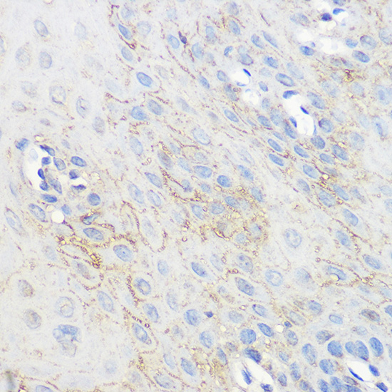 Immunohistochemistry of paraffin-embedded human esophageal using ADORA1 Polyclonal Antibody at dilution of 1:100 (40x lens).Perform microwave antigen retrieval with 10 mM PBS buffer pH 7.2 before commencing with IHC staining protocol.