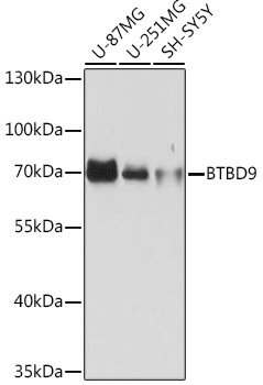 Western blot analysis of extracts of various cell lines using BTBD9 Polyclonal Antibody at1:1000 dilution.