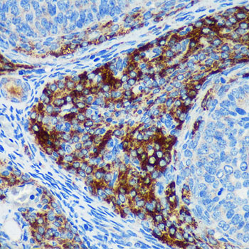 Immunohistochemistry of paraffin-embedded Rat ovary using PIGU Polyclonal Antibody at dilution of 1:100 (40x lens).Perform microwave antigen retrieval with 10 mM PBS buffer pH 7.2 before commencing with IHC staining protocol.