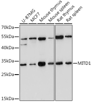 Western blot analysis of extracts of various cell lines using MITD1 Polyclonal Antibody at1:1000 dilution.