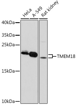 Western blot analysis of extracts of various cell lines using TMEM18 pAb Polyclonal Antibody at1:1000 dilution.