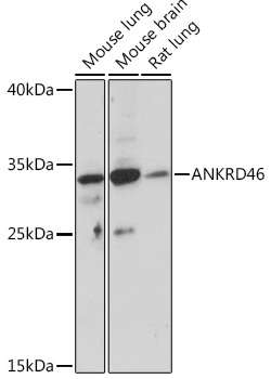 Western blot analysis of extracts of various cell lines using ANKRD46 Polyclonal Antibody at1:1000 dilution.