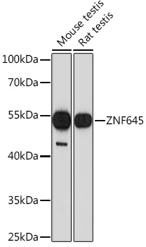 Western blot analysis of extracts of various cell lines using ZNF645 Polyclonal Antibody at1:1000 dilution.