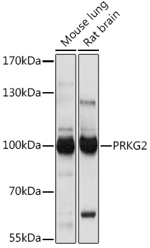 Western blot analysis of extracts of various cell lines using PRKG2 Polyclonal Antibody at1:1000 dilution.