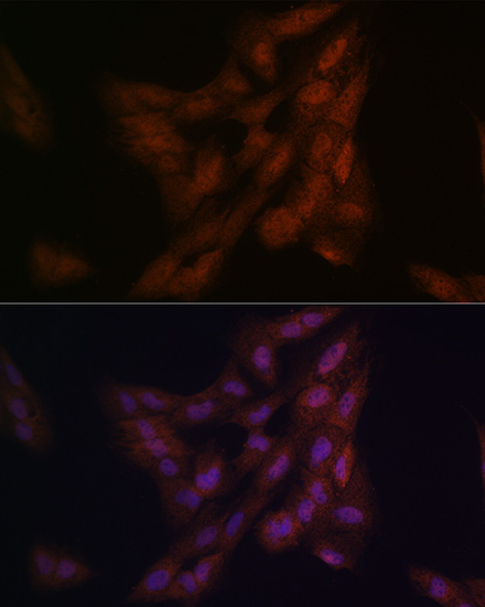 Immunofluorescence analysis of C6 cells using DJ-1/PARK7 Polyclonal Antibody at dilution of 1:100 (40x lens). Blue: DAPI for nuclear staining.