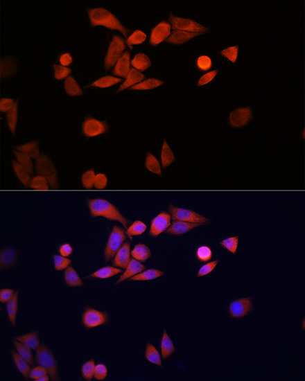 Immunofluorescence analysis of HeLa cells using DJ-1/PARK7 Polyclonal Antibody at dilution of 1:100 (40x lens). Blue: DAPI for nuclear staining.