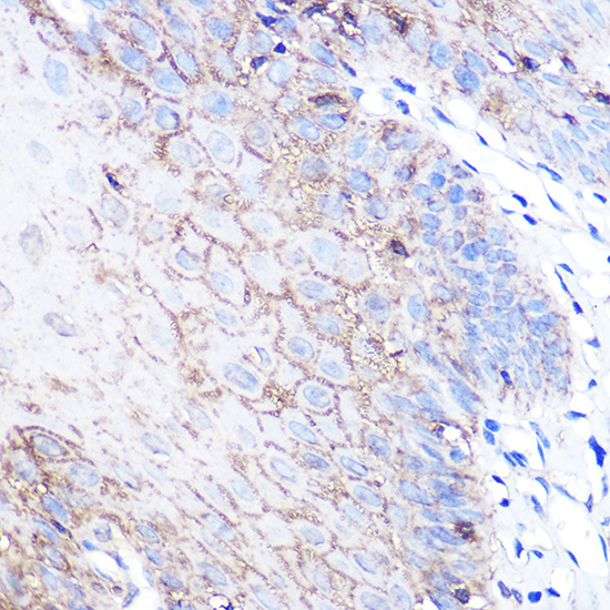 Immunohistochemistry of paraffin-embedded human esophageal using DJ-1/PARK7 Polyclonal Antibody at dilution of 1:100 (40x lens).Perform microwave antigen retrieval with 10 mM PBS buffer pH 7.2 before commencing with IHC staining protocol.