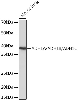 Western blot analysis of extracts of Mouse lung using ADH1A/ADH1B/ADH1C Polyclonal Antibody at1:1000 dilution.