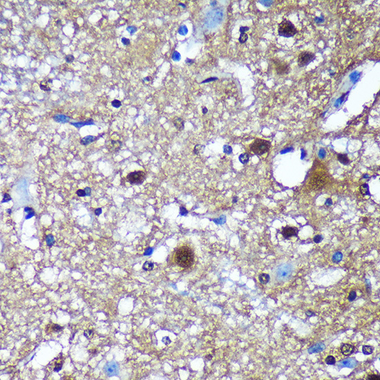 Immunohistochemistry of paraffin-embedded Mouse spinal cord using TSN Polyclonal Antibody at dilution of 1:100 (40x lens).Perform microwave antigen retrieval with 10 mM PBS buffer pH 7.2 before commencing with IHC staining protocol.