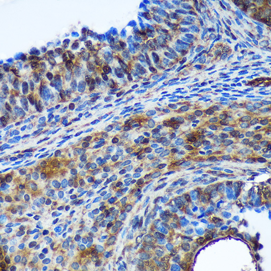 Immunohistochemistry of paraffin-embedded Rat ovary using TSN Polyclonal Antibody at dilution of 1:100 (40x lens).Perform microwave antigen retrieval with 10 mM PBS buffer pH 7.2 before commencing with IHC staining protocol.