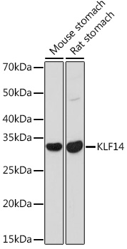 Western blot analysis of extracts of various cell lines using KLF14 Polyclonal Antibody at 1:1000 dilution.