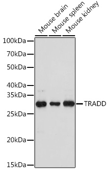 Western blot analysis of extracts of various cell lines using TRADD Polyclonal Antibody at 1:1000 dilution.