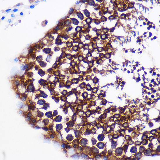 Immunohistochemistry of paraffin-embedded Rat testis using PTGES Polyclonal Antibody at dilution of 1:100 (40x lens).Perform microwave antigen retrieval with 10 mM PBS buffer pH 7.2 before commencing with IHC staining protocol.