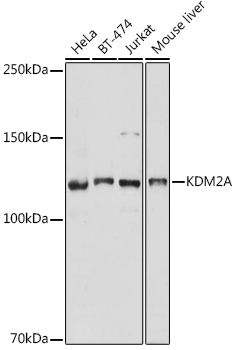 Western blot analysis of extracts of various cell lines using KDM2A Polyclonal Antibody at 1:1000 dilution.