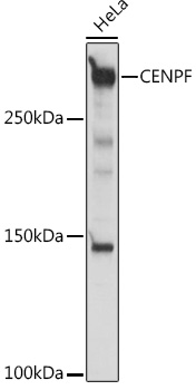 Western blot analysis of extracts of HeLa cells using CENPF Polyclonal Antibody at 1:1000 dilution.