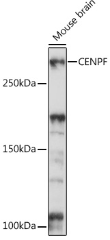 Western blot analysis of extracts of Mouse brain using CENPF Polyclonal Antibody at 1:1000 dilution.