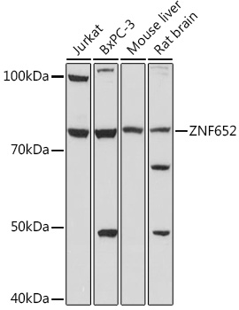 Western blot analysis of extracts of various cell lines using ZNF652 Polyclonal Antibody at 1:1000 dilution.