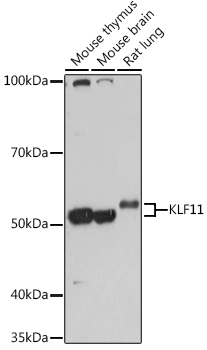 Western blot analysis of extracts of various cell lines using KLF11 Polyclonal Antibody at 1:1000 dilution.