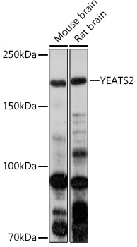 Western blot analysis of extracts of various cell lines using YEATS2 Polyclonal Antibody at 1:1000 dilution.